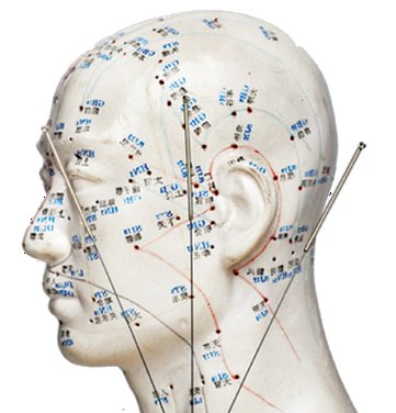 Acupuncture